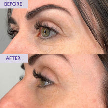 Load image into Gallery viewer, Skinician Eye Peptide Complex
